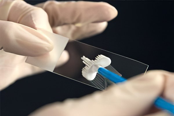 Сколько делается анализ Сколько делается анализ