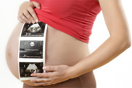 Скрининг третьего триместра Скрининг третьего триместра