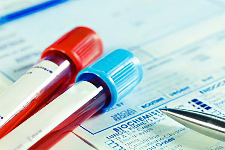 Тиреоглобулин Тиреоглобулин