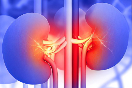 Причины тромбоза почечных вен Причины тромбоза почечных вен