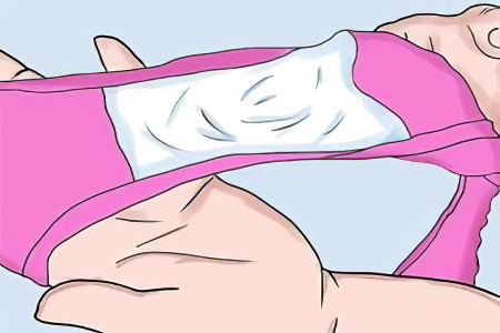 Вагинальные выделения Вагинальные выделения