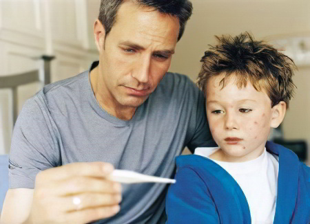 лечение ветрянки лечение ветрянки