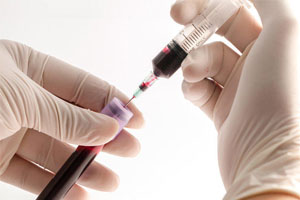 Виды и показатели Виды и показатели