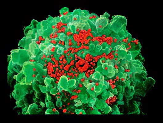 Инфекционный мононуклеоз Инфекционный мононуклеоз