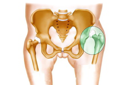 Вывих Вывих