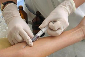 Внутривенное введение магнезии Внутривенное введение магнезии