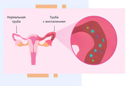 Заболевания внутренних органов Заболевания внутренних органов