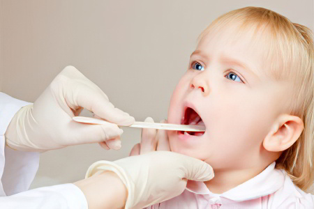 Воспалённые гланды у ребёнка Воспалённые гланды у ребёнка