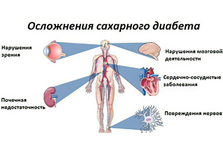 Возможные осложнения Возможные осложнения