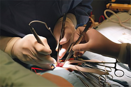 Удаление желчного пузыря Удаление желчного пузыря