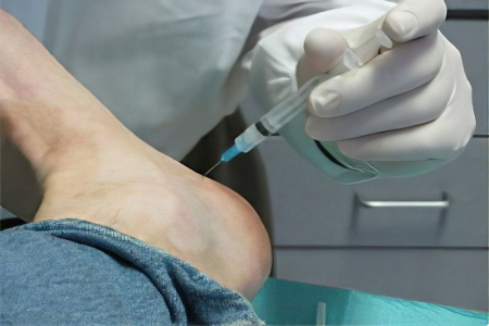 Укол в пятку Укол в пятку