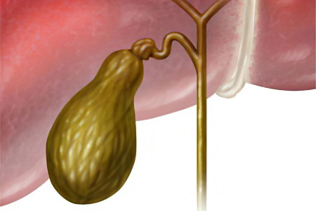 Застой желчи Застой желчи